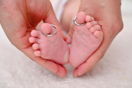 扶余宝宝有痱子怎么办